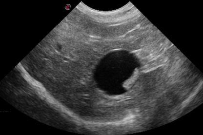 Practical Abdominal Ultrasound Scanning Day