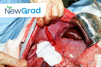New Graduate – Abdominal Surgery Techniques