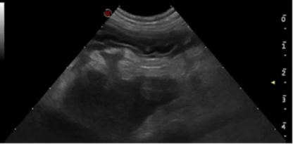 Advanced Ultrasound - Image 2