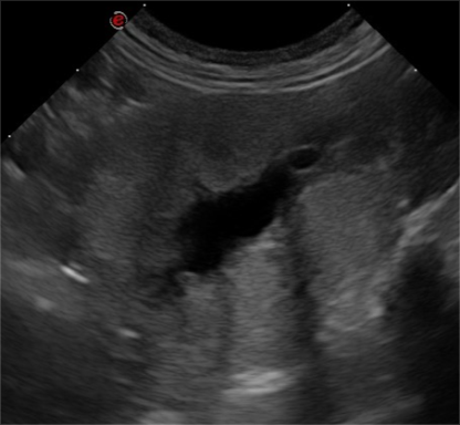 Advanced Ultrasound - Image 4