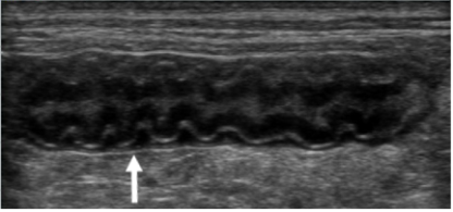Advanced Ultrasound - Image 5