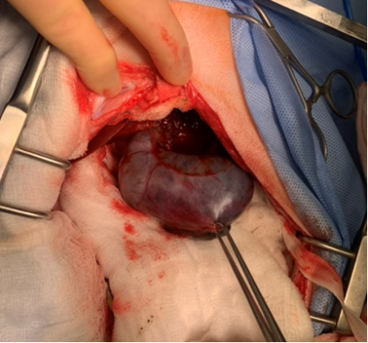 Abdominal Surgery - Image 5