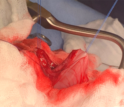 Abdominal Surgery - Image 4