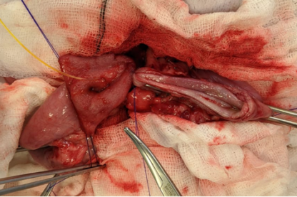 Abdominal Surgery - Image 3
