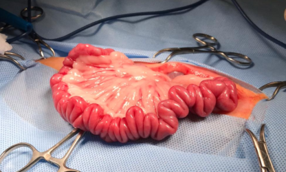Abdominal Surgery - Image 2