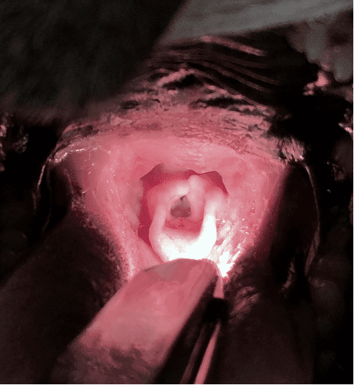 Brachycephalic Obstructive Airway Syndrome (BOAS) - Image 2
