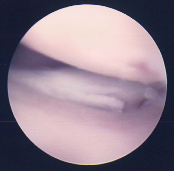 Introduction to Arthroscopy - Image 3