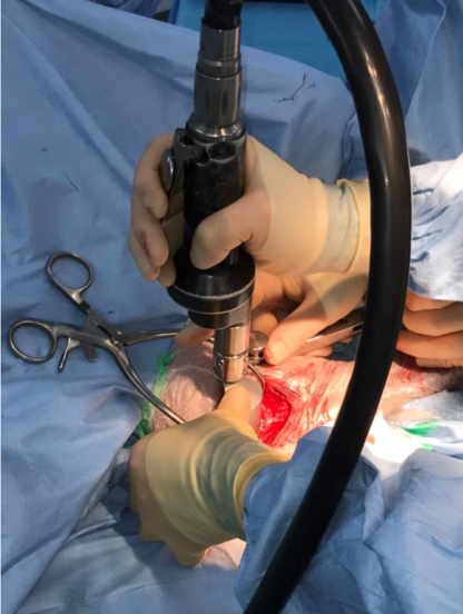 Learn TPLO - Image 4