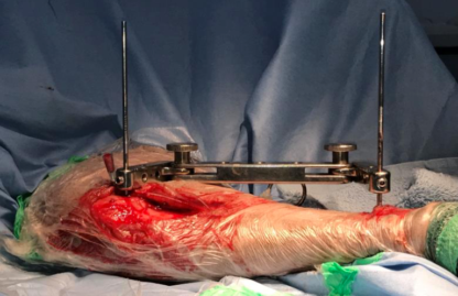 Learn TPLO - Image 5
