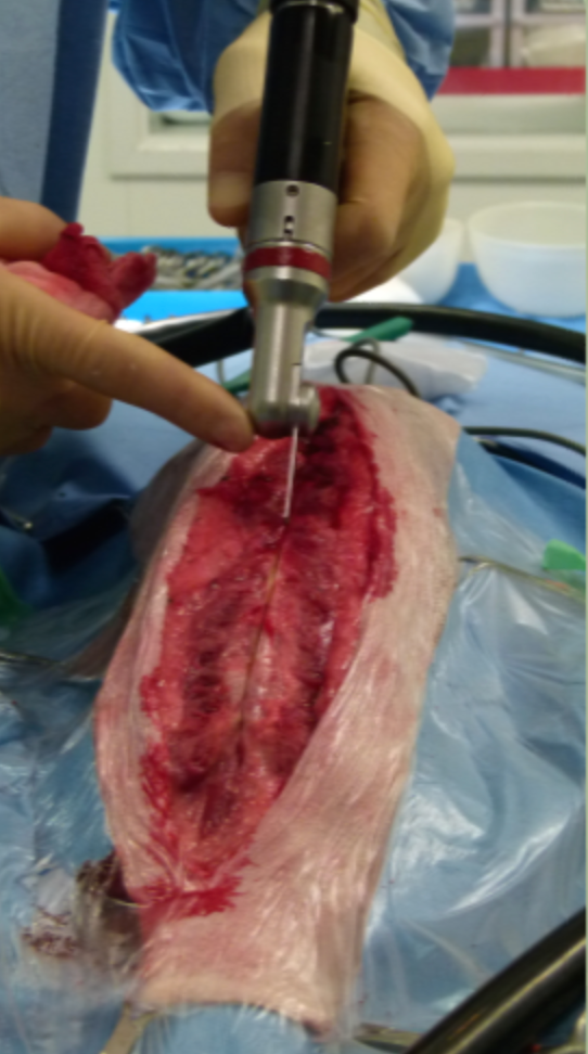 Thoracic Surgery - Image 2