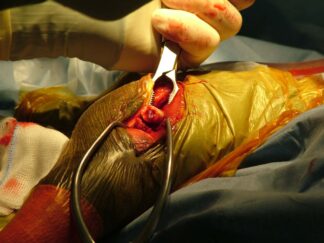Practical Fracture Fixation