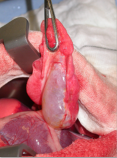 Thoracic Surgery - Image 3