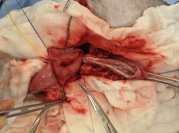 Advanced Abdominal Surgery - Image 4