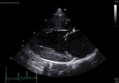 MS296 - Cardiac Ultrasound