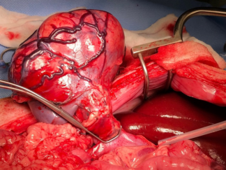 advanced abdominal surgery course image