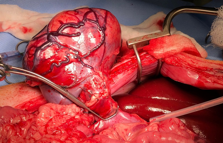 advanced abdominal surgery course image