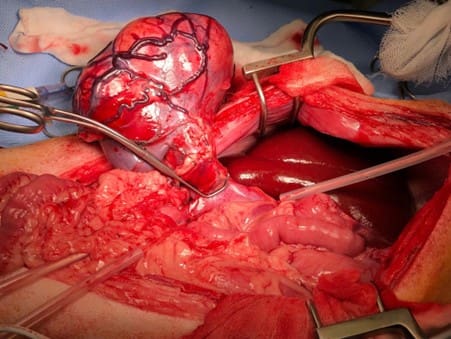 Advanced Abdominal Surgery - Image 3