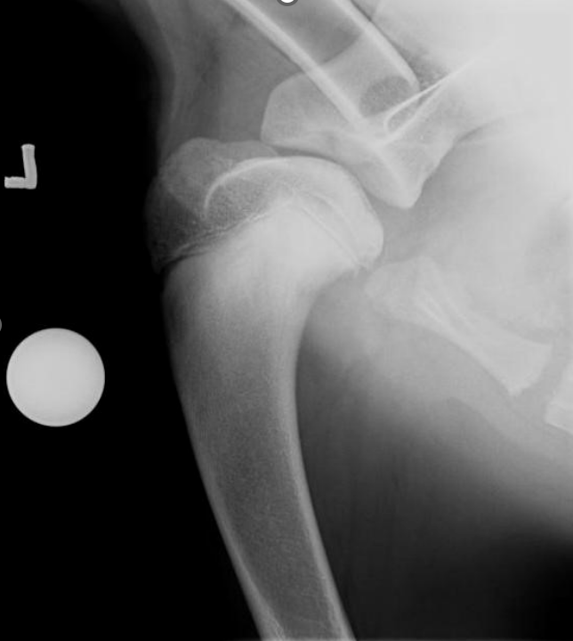 Joint Surgery