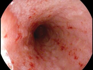 Practical Endoscopy - Gokce Emrealp