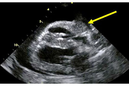 AD150 - Advance25 - Cardiac Ultrasound - Image 2
