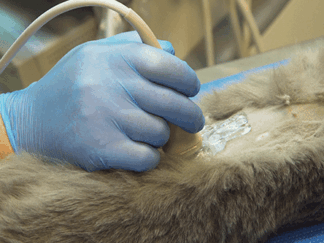 AD155 - Advance25 Abdominal Ultrasound