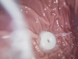 Advanced Practical Endoscopy