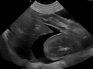 Diagnostic Imaging