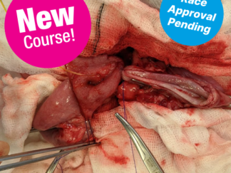 AD156 - Advance25 - Advanced Abdominal Surgery