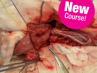 AD156 - Advance25 - Advanced Abdominal Surgery
