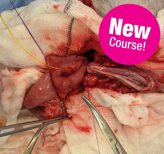 AD156 - Advance25 - Advanced Abdominal Surgery