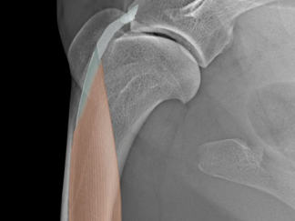 Practical Musculoskeletal Ultrasound Level 1