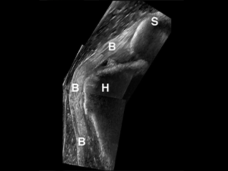 Musculoskeletal Ultrasound