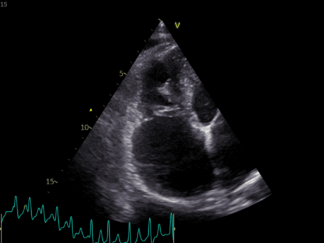 Advanced Clinical Programme in Small Animal Cardiology